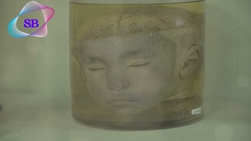 Understanding Types of Tissue Fixation #shorts #fixative