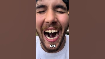 Losing your tongue isn’t just about speech, it’s worse!😱👅