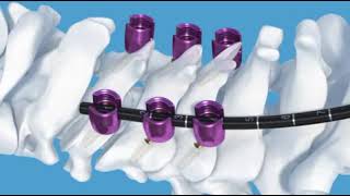 DepuySynthes: Synapse