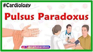 Pulsus Paradoxus - Examination of the arterial pulse ( Cardiology, #USMLE ) Resimi