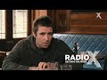 Capture de la vidéo Chris Moyles Meets Liam Gallagher | Full Interview | Radio X