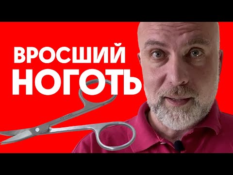 Вросший ноготь лечение в домашних условиях. Первая помощь