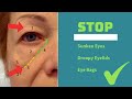 12 Min Anti-Aging Massage for Tear Troughs, Under Eye Bags & Hollow