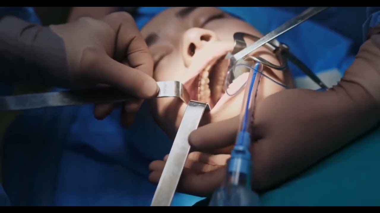 mouth-surgery-doctor-medical-surgery-medical-youtube