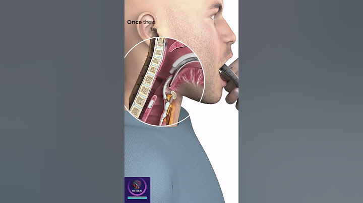 Endotracheal Intubation #education #shorts