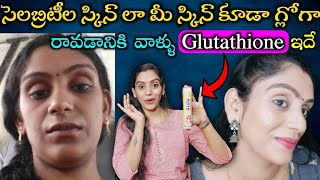 how much iv glutathione cost how often to do glutathione iv Glutathione Injection Cost, Benefits, Side  Effects
