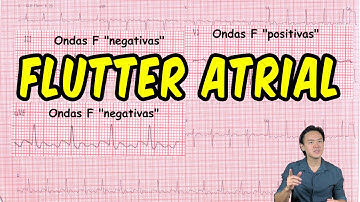 Eletrocardiograma - análise - flutter atrial