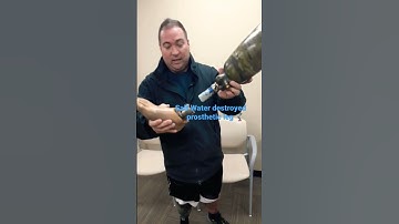 Amputees Beware!🦿 #prosthetics