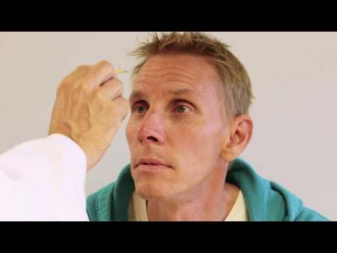 Video: Ansiktsnervneurit - Neurolog Om Symtom Och Behandling