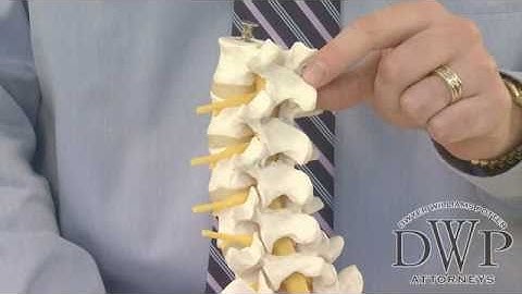 Anatomy of the Spine and Introduction to Spinal Cord Injuries