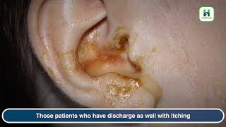 Why Do My Ears Itch | causes of itchy ears - Dr. Raman Abrol