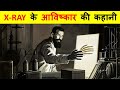 X-Ray का आविष्कार कब और किसने किया ? COMPLETE HISTORY OF THE INVENTION OF X-RAY.