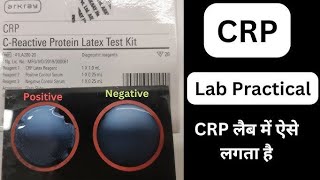 C-Reactive Protein Test Procedure (CRP) Latex Kit Video.C-Reactive Protein Quantitative Test