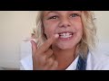 HER TURN TO GET BRACES | THE LEROYS