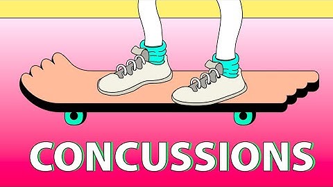 Concussions