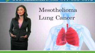 Asbestos Exposure - Malignant Lung Cancer - Los Angeles