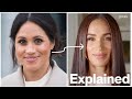 Meghan markles new face explained