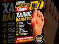 № 7 Запись прямого эфира! Халюс Вальгус!