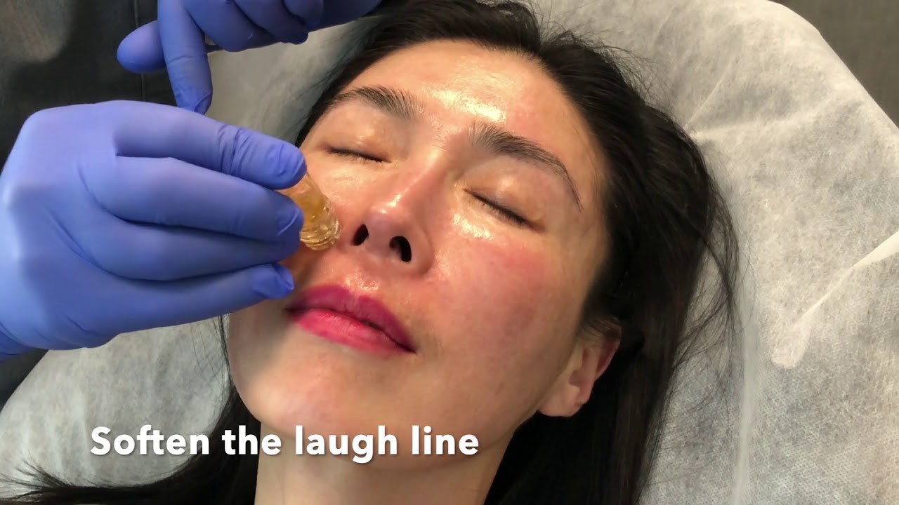 Meso Botox Filler Facial Rejuvenation - Omeed Sani MD - Sani Aesthetics
