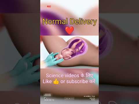 Normal Child Delivery | Baby Birth Shorts Youtubeshorts Viral Neetmotivation