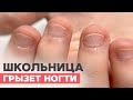 Сгрызла ногти | Маникюр для школьницы