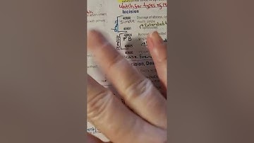 REPEAT LIVE 2-28-22 Medical decision making coding and billing certification exam prep cpc ahima