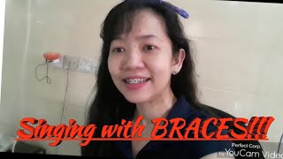 Singing with BRACES!!  Can Braces Affect your Singing??