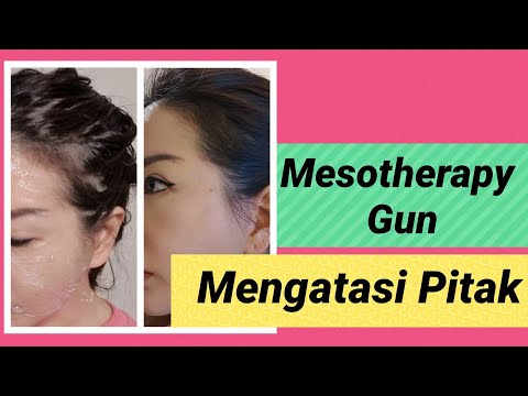 Mengatasi Pitak Dengan
