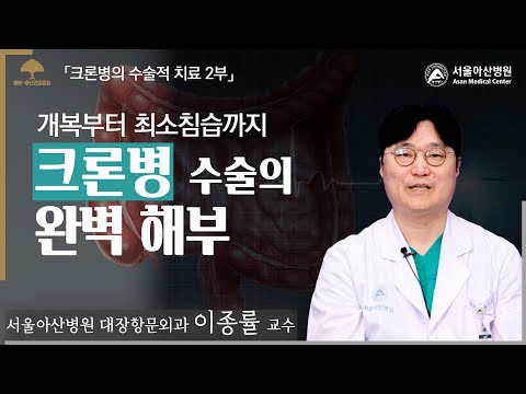[크론병의 수술적 치료 2부] 개복부터 최소침습까지 - 크론병 수술의 완벽 해부: 대장항문외과 이종률 교수 ㅣ 동아아산건강강좌