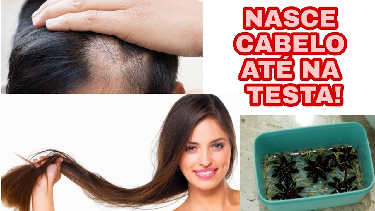 NÃO USE MUITO! CRESCE CABELO MUITO RÁPIDO! CRESCE BARBA, SOBRANCELHA E ACABA COM FALHAS