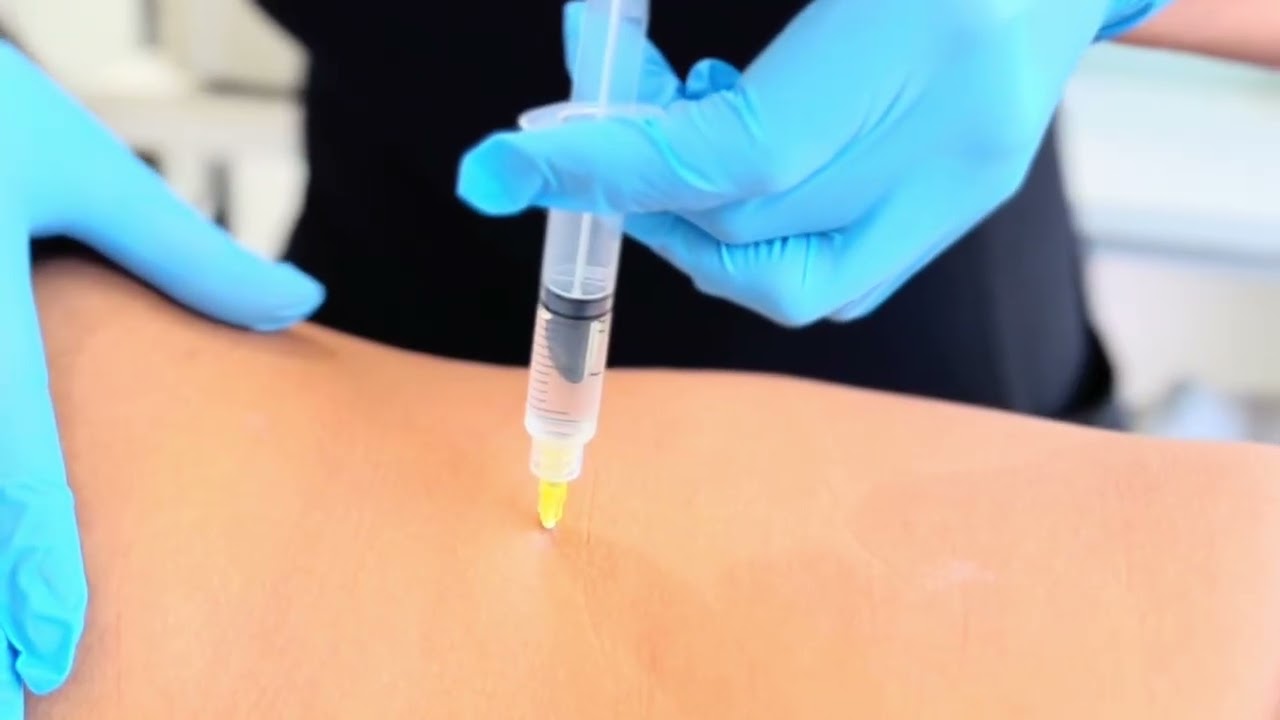como se aplica l carnitina inyectable Recupera la confianza con Fosfatidilcolina y L-carnitina main image 0
