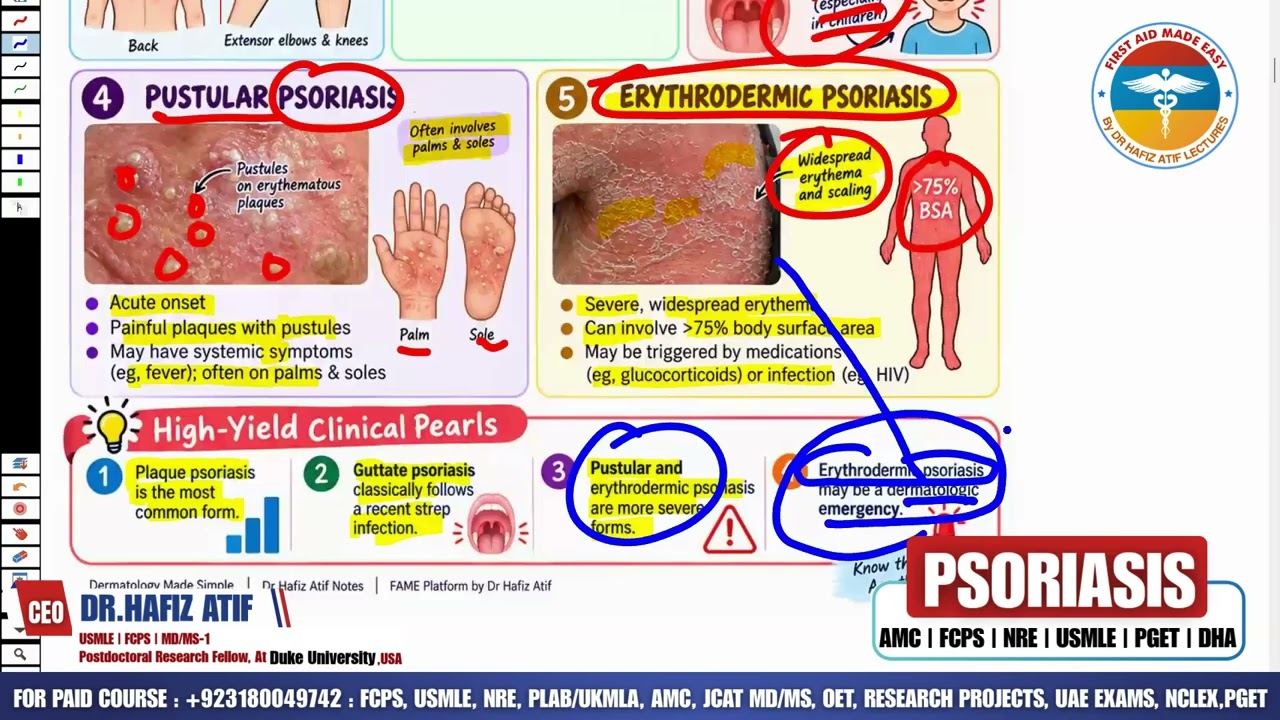 PSORIASIS | Rapid Revision | High-Yield Topic for AMC | FCPS | NRE | USMLE |PGET |DHA |Dr Hafiz Atif