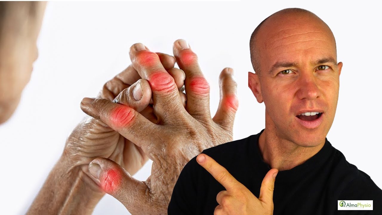 Il miglior integratore per L' ARTRITE (non è la vitamina D)