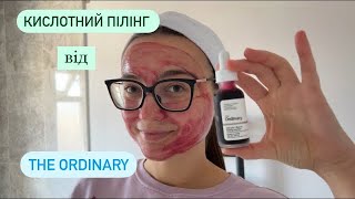 :  ϲ˲ The Ordinary:  .