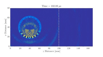 FDTD Simulation of Source in Spherical Shell