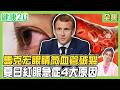 眼疾3狀況需動手術！馬克宏眼睛微血管破裂 眼睛「這處」爆血管恐中風警訊！夏日紅眼急症4原因 保護眼血管「這樣做」！健康2.0 20260726【完整版】#鄭凱云#陳瑩山#鄭明軒#趙函穎#吳明珠#雷議宗