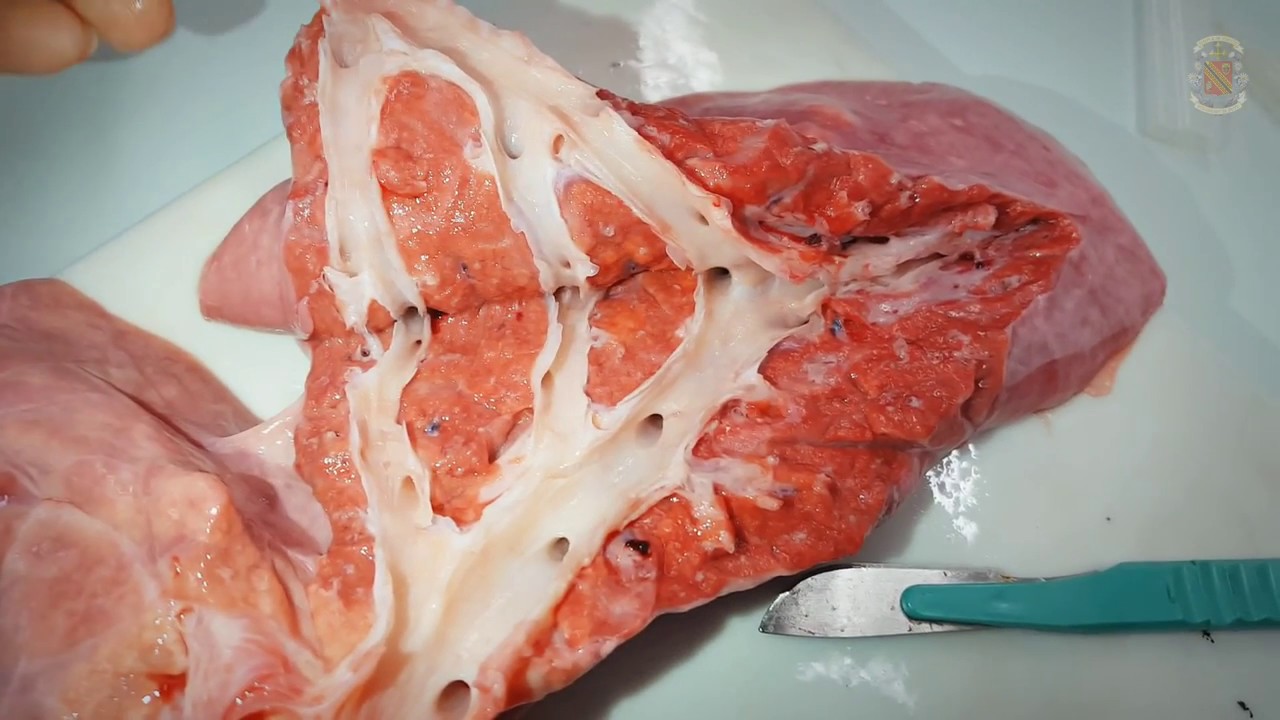 lungs dissection biology lab techniques youtube