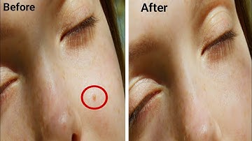 How to Remove Pimples from face in video using Adobe Premiere Pro in हिन्दी