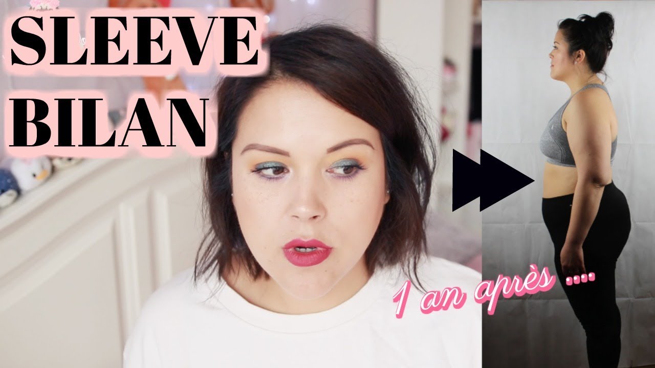 BILAN SLEEVE: 1 AN APRES REUSSITE OU ECHEC ?