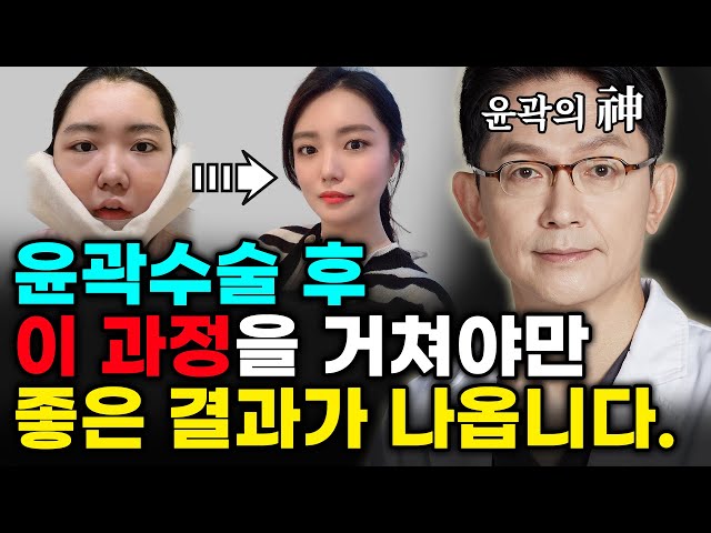 윤곽수술 후, 이 과정을 거쳐야만 좋은 결과가 나옵니다😎
