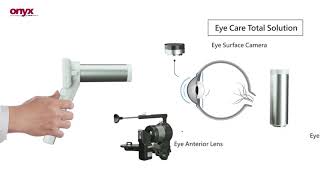 [ DSC-300P ]High-end Digital Diagnostic Scope  | Onyx Healthcare