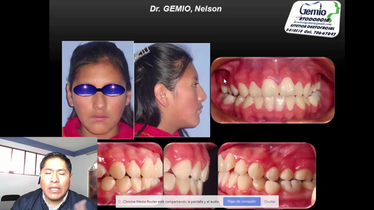 #1 Introducción a la Ortodoncia