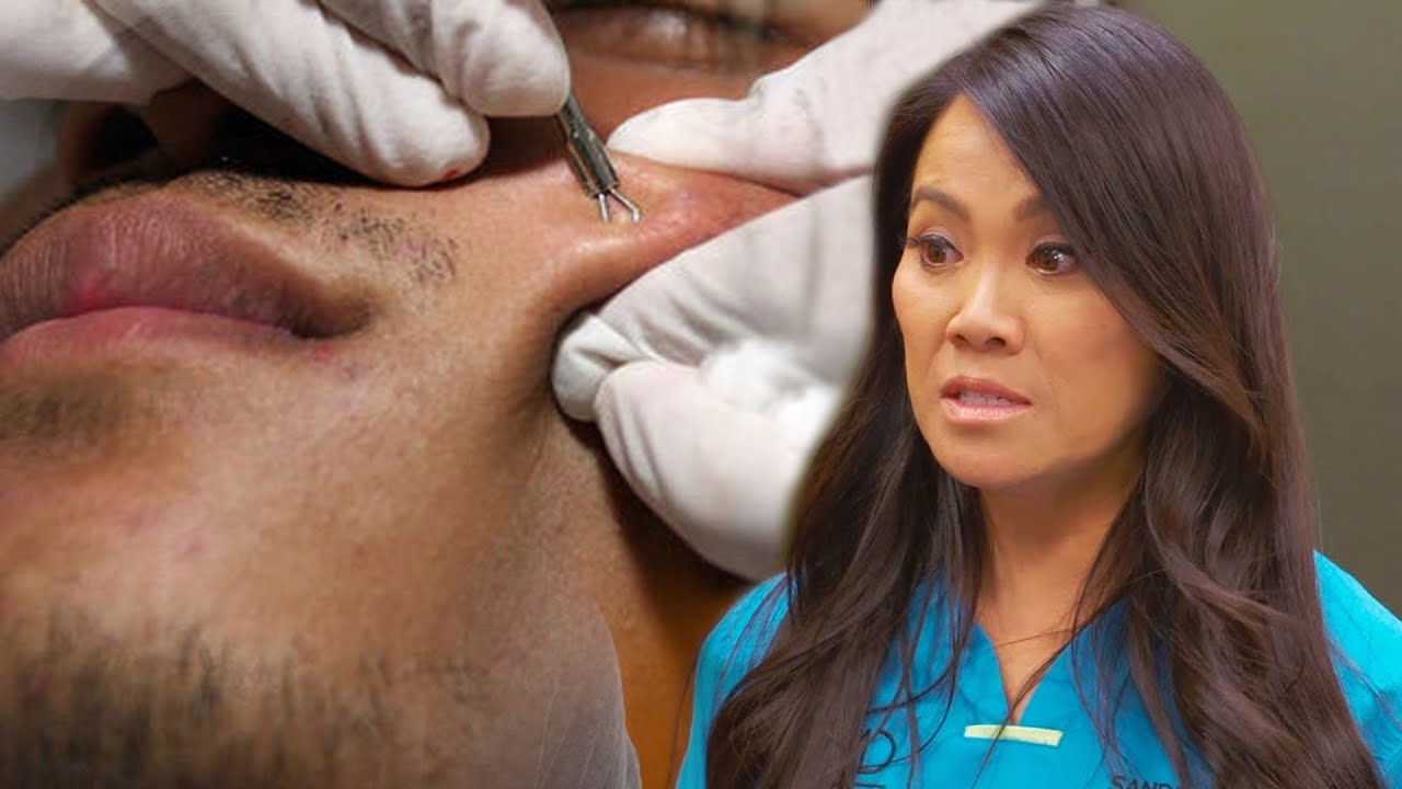 youtube dr pimple popper