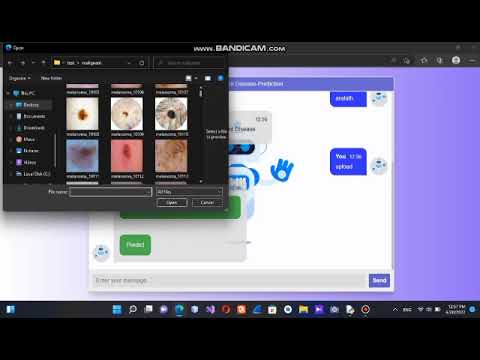 skin cancer detection webapplication project in python