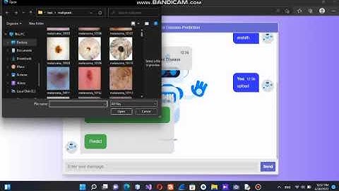 skin cancer detection webapplication project in python