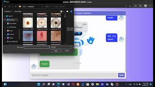 skin cancer detection webapplication project in python
