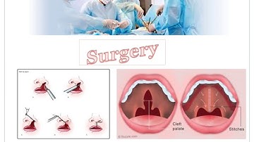 Speech Sound Disorder Video