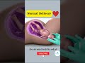 NORMAL CHILD DELIVERY | BABY BIRTH #shorts #youtubeshorts #viral