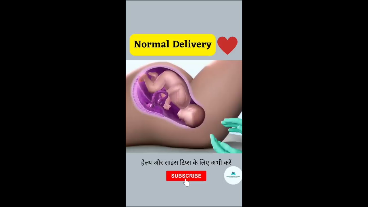 NORMAL CHILD DELIVERY  BABY BIRTH  shorts  youtubeshorts  viral