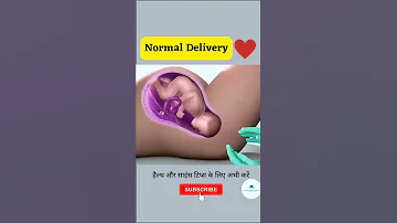 NORMAL CHILD DELIVERY | BABY BIRTH #shorts #youtubeshorts #viral